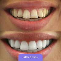 PAP Whitening Strips